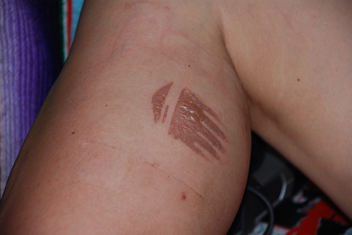 Isabella gebrandmarkt: Der Töffauspuff hat seinen Abdruck hinterlassen